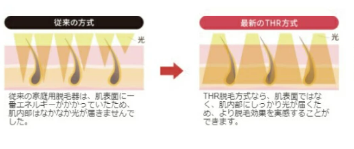 脱毛